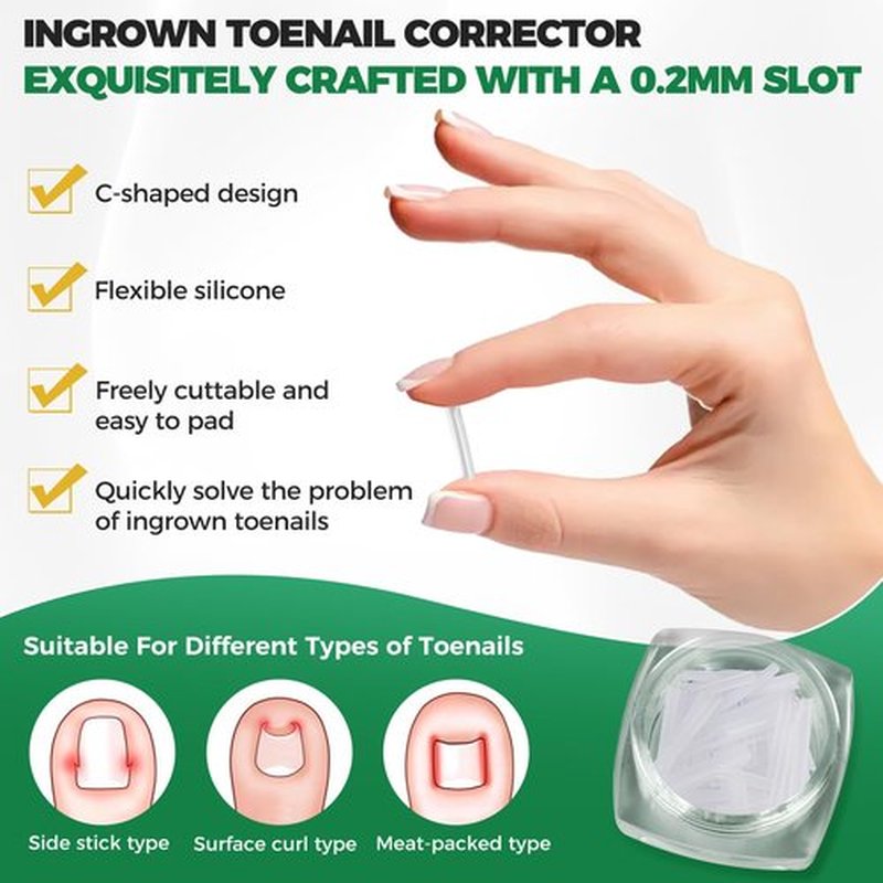 Ingrown Toenail Kit - Ingrown Toenail Drops, Ingrown Toenail Set - 60 Pcs Toenail Straightener Strips -Toenail Lifter Small Scissors