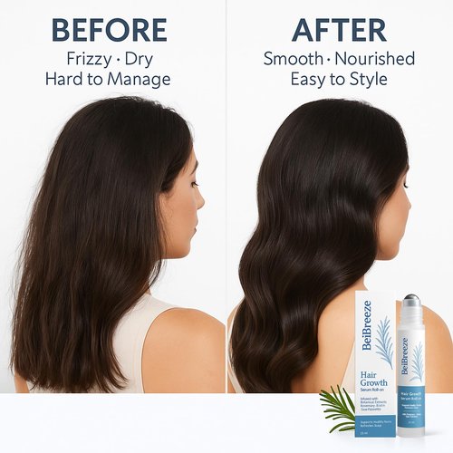 BeiBreeze Rosemary Hair Growth Serum Roll On 25ml – Infused with Rosemary, Biotin & Saw Palmetto | Fast-Absorbing Scalp Serum for Thicker, Fuller Hair | Non-Greasy, For Men & Women