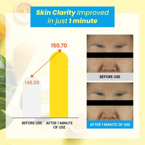 BRINGGREEN Super Lemon Fresh Mask 10ea