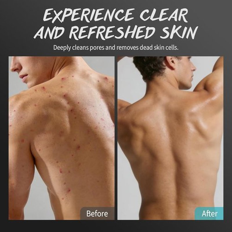 Men's Body Scrub by [Brand Name] - Exfoliating Tea Tree Oil Formula for Smooth Skin | 2% BHA & 10% AHA