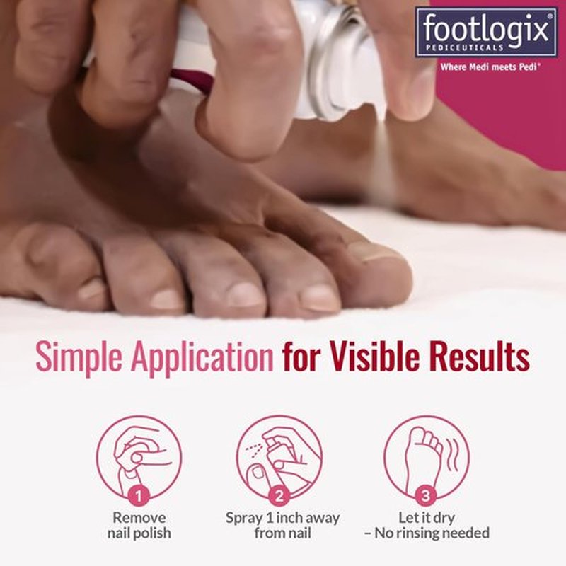 Footlogix Nail Tincture Spray - Spiraleen Formula for Healthy Nails | 1.55 Fl Oz