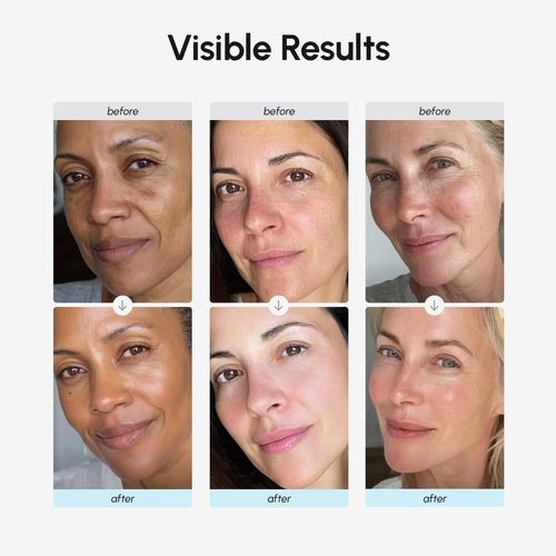 MAREE Face Moisturizer Retinol Cream for Face – Daily Wrinkle Cream for Women – Anti-Aging Face Cream – Facial Moisturizer with Collagen – Crema Hidratante Para la Cara for Skin Tightening