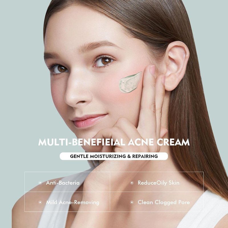 Azelaic Acid Serum by Regine Switzerland - Acne Treatment & Pore Refining Cream | 30ml for Sensitive Skin