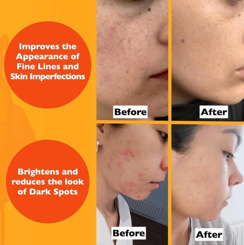 Regine Switzerland Vitamin C Serum - Anti-Aging Formula with Hyaluronic Acid & Vitamin E | 2 Fl Oz