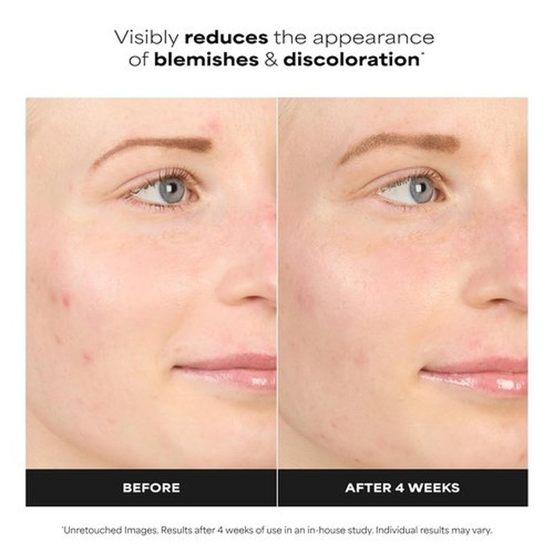 Paula's Choice BOOST 10% Azelaic Acid Gel Serum - Oil-Free, Skin Brightening, Fragrance-Free