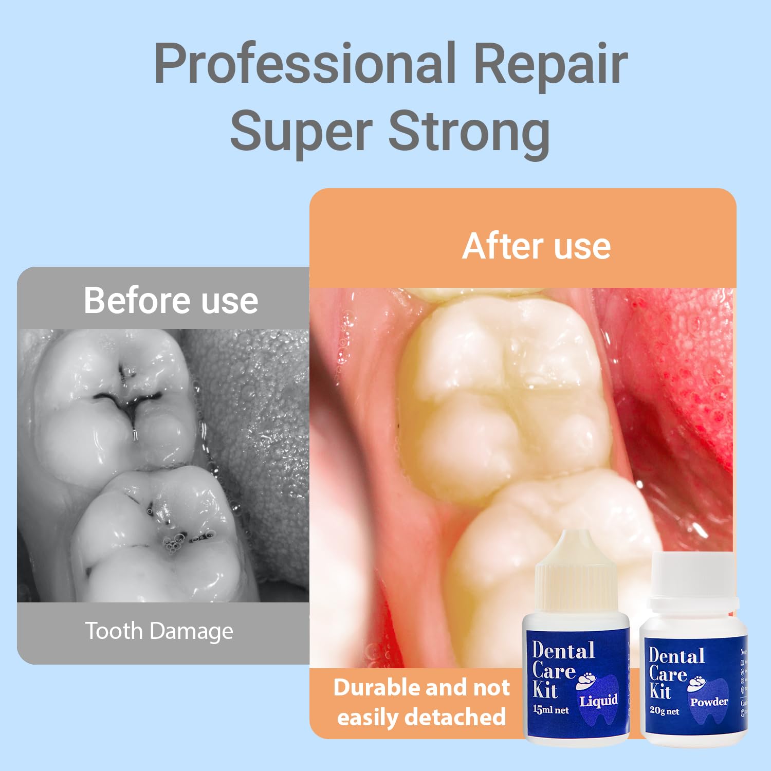 Tooth Repair Kit,Zinc Oxide Eugenol - Dental Cement,Cavity Filler for Teeth,for Crowns & Bridges Filling,Dental Glue,Provide Video tutorials 2pcs