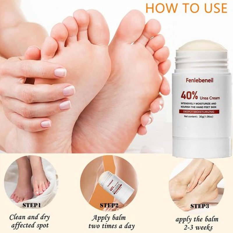 fenlebeneil 40% Urea Cream Cracked Heel Balm for Dry, Cracked Feet, Heals, Foot Hand Moisturizing 40 Percent Foot Urea Cream for Feet Maximum Strength 2Pack