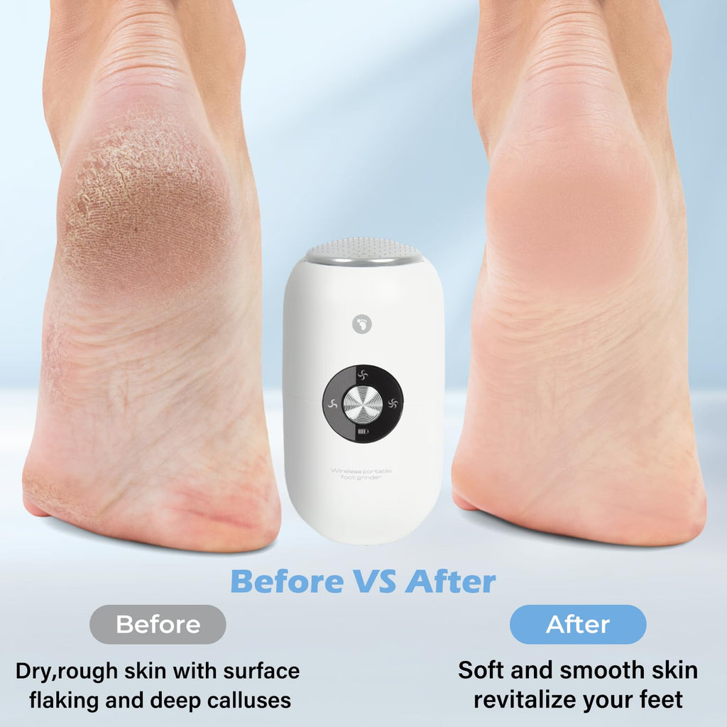 Electric Foot Callus Remover Grinder - Rechargeable Pedicure Tools Callus Remover for Feet Foot Scrubber File Foot Care with 3 Speeds 2 Stainless Grinding Heads for Hard Cracked Dry Dead Skin