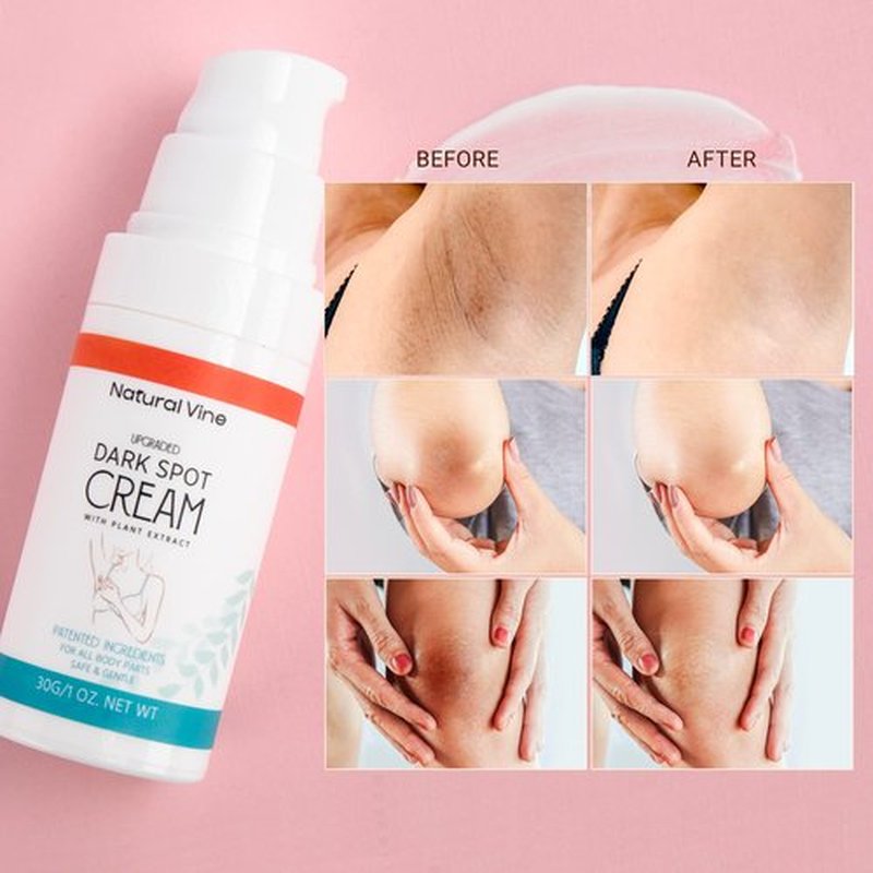 Natural Vine Dark Spot Corrector: Dark Spot Remover for Body in 4-8 Weeks - Instant Concealing & Age Brown Sun Faded Spot Remover Melasma Freckles Correcting with Niacinamide for Women & Men 30g