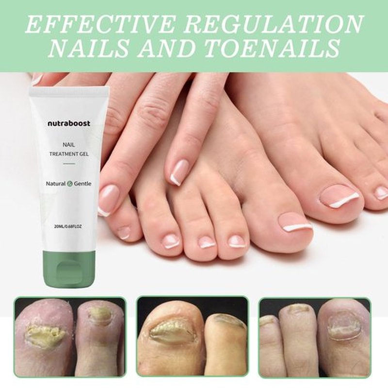 Nutraboost Nail Treatment Gel, Nail Growth Serum for Repair & Strengthener, Multi-Purpose Nail Repair Oil Serum, Foot Care Cream(1pcs)