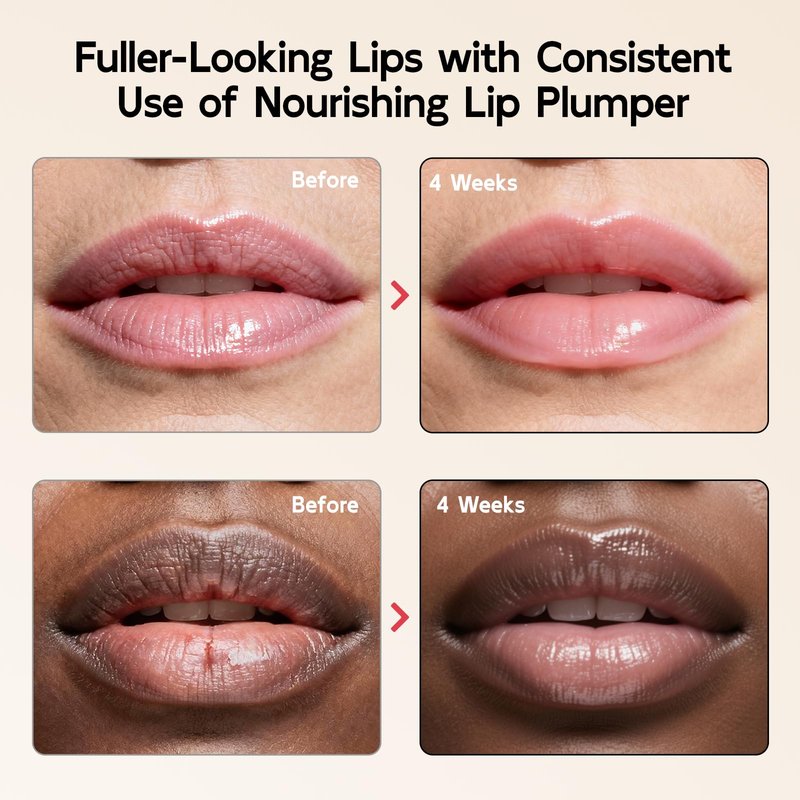 YouthVibe 5% Volufiline Lip Plumper, Nourishing & Anti Aging Over Time with Squalane, Shea Butter, Collagen, Peptide & PDRN - No Burning, No Tingling for Gentle Daily Plumping, 0.35 Ounce (Pack of 1)