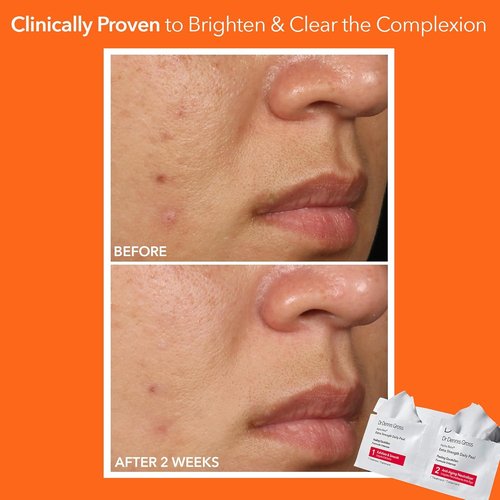 Dr. Dennis Gross Alpha Beta Extra Strength Daily Peel - 2-Step Exfoliating Pads for Radiant Skin | 5 Treatments