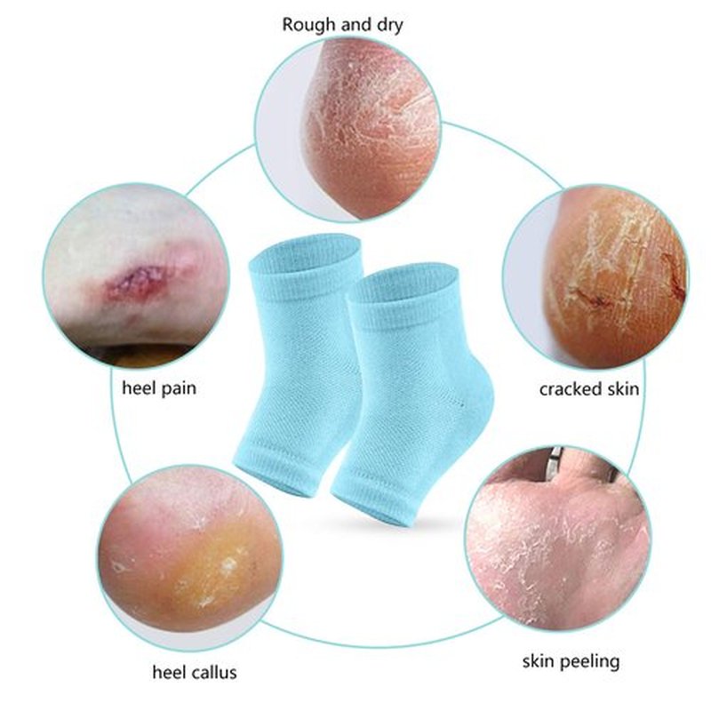 Senkary 4 Pairs Heel Moisturizing Socks Open Toe Socks Gel Heel Socks Cotton for Dry Cracked Feet Women Men (Pink, Turquoise, Blue, Grey)