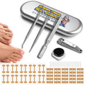 Ingrown Toenail Corrector Kit - Professional Home Pedicure Care for Toenail - Includes Toenail Correction Strips for Ingrown Toenail Relief Removal