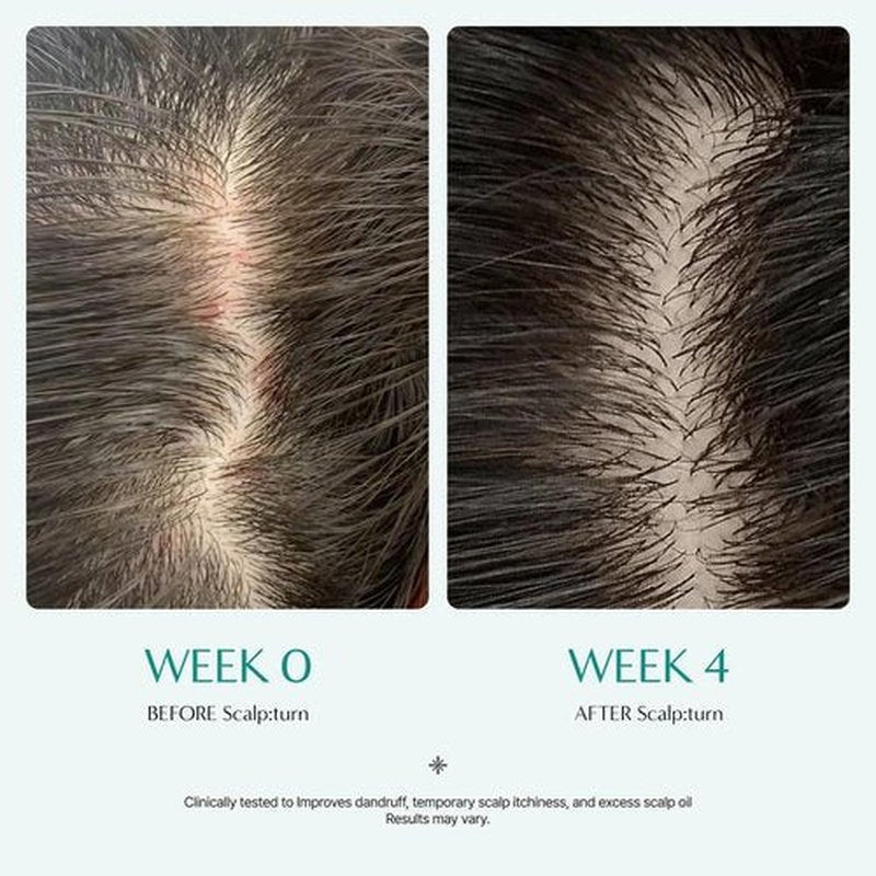 Lilyeve SCALPTURN Cica PDRN Scalp Serum - Strengthen Hair Roots & Relieve Itchy Scalp | 3.38 fl. oz.