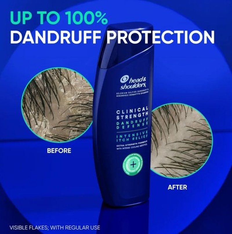 Head & Shoulders Clinical Strength Dandruff Defense 2-in-1 Shampoo + Conditioner, Itch Relief Shampoo, Flake Control, Seborrheic Dermatitis Care, 13.5 Ounce Bottles, Pack of 2