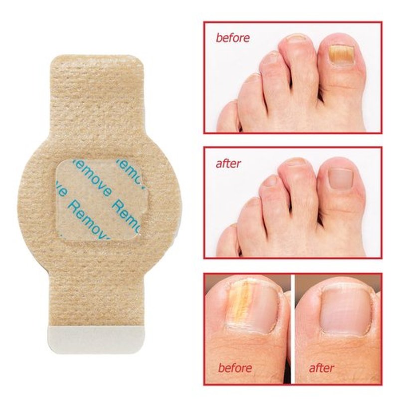 Nail Patches 21Pcs, Toenail Care Treatment Extra Strength, 8-Hour Overnight Hydrogel Nail Repair Patches for Damaged Nails, Improve Toenails Texture & Thickening
