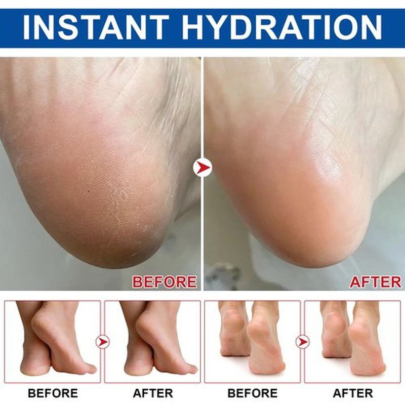 DNQYWODQ 60% Urea Cream Stick plus 2% Salicylic Acid | Intensive Moisturizing Balm for Rough & Dry Skin | Exfoliating Foot & Hand Softener | 1.4oz Twist-Up Stick