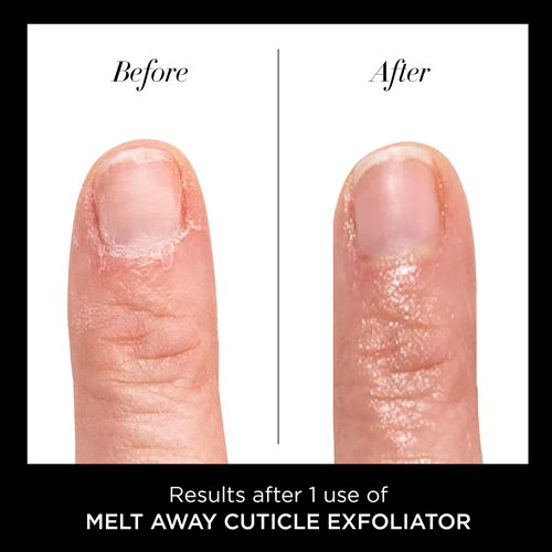 butter LONDON Cuticle Remover Liquid, Melt Away - Cuticle Oil Exfoliator & Softener Gently Removes Dry, Overgrown Cuticles for Healthy Looking Nails - Fast-Acting & Pain-Free Formula - 0.4 Fl Oz
