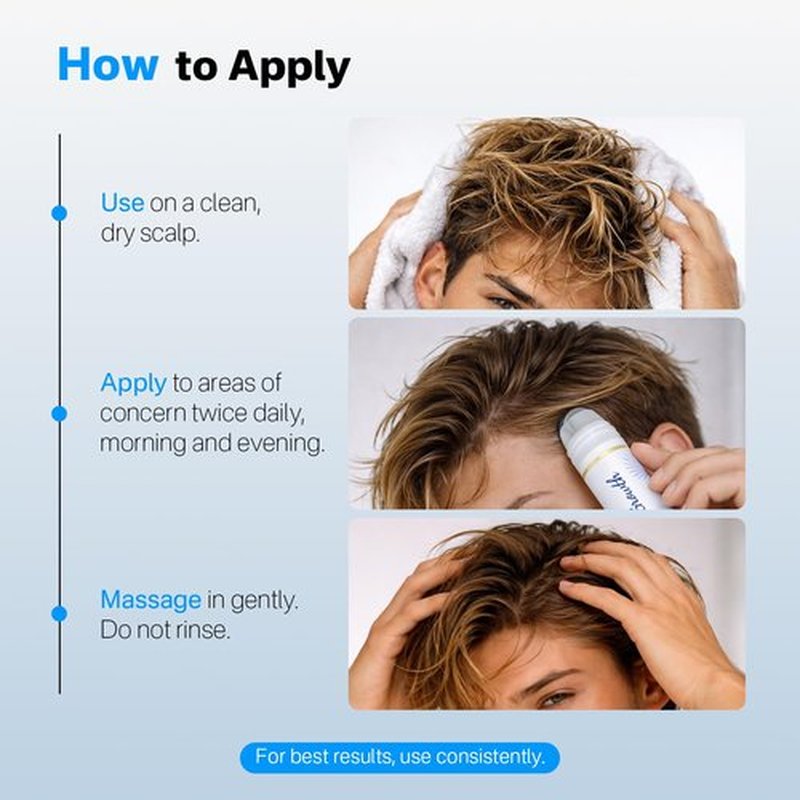 SORNBEO Hair Growth Serum Roll On with Rosemary,Non-Greasy Scalp Serum for Thinning Hair, Helps Reduce Hair Fall & Supports Thicker, Fuller-Looking Hair, Saw Palmetto, 0.84 Fl Oz，Pack of 1