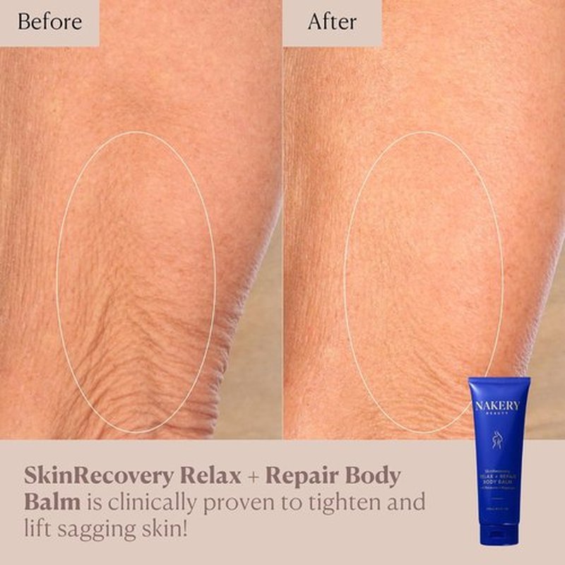 Nakery SkinRecovery Magnesium Balm - Relaxing Skin Tightening Cream with SepiLift & Retinol | Hydrating Muscle Balm with Melatonin for Restful Sleep