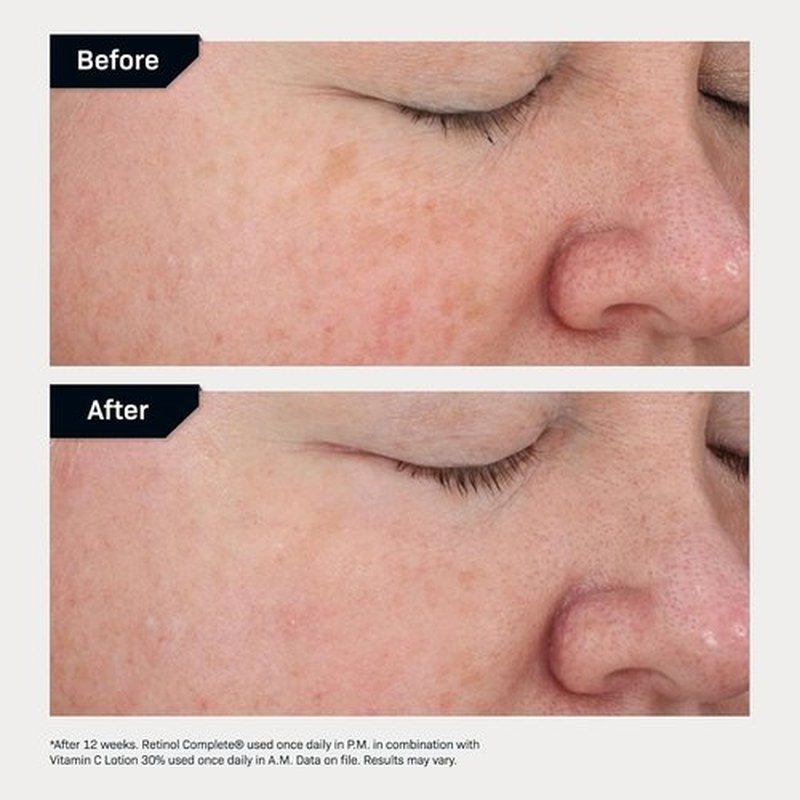 Revision Skincare Retinol Complete® 0.5 Anti-Aging Serum - Reduces Fine Lines & Wrinkles, Hydrating Formula