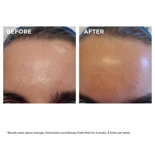 Clarins Beauty Flash Peel - 10-Minute At-Home Facial for Pore Tightening & Skin Renewal | All Skin Types