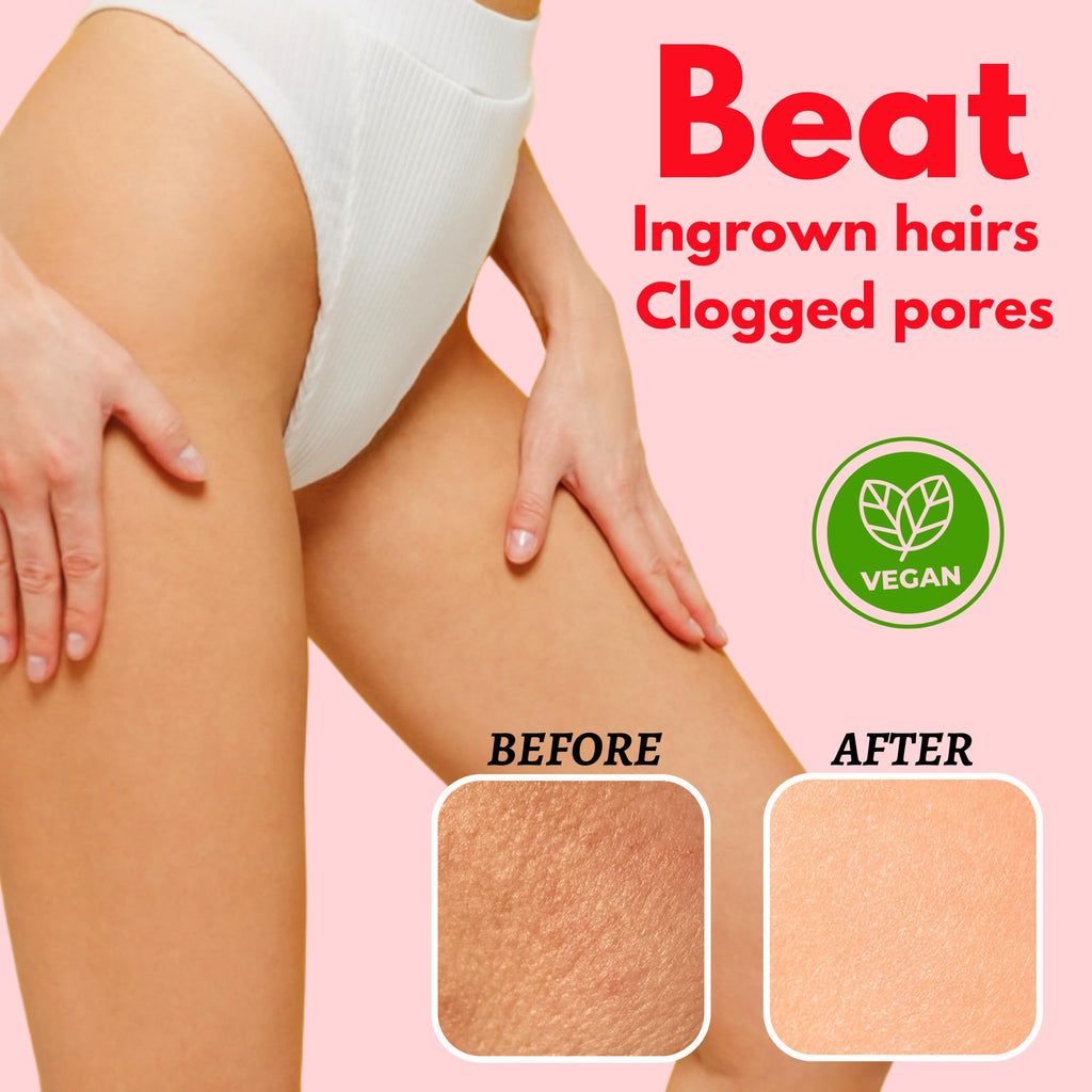 Bikini Area Exfoliator Pack 2-2% Kojic Acid Vitamin C & 7% AHA/BHA Even Skin Tone, Radiance & Glow Skin & Ingrown Hair for Rectum Intimate Butt Underarm