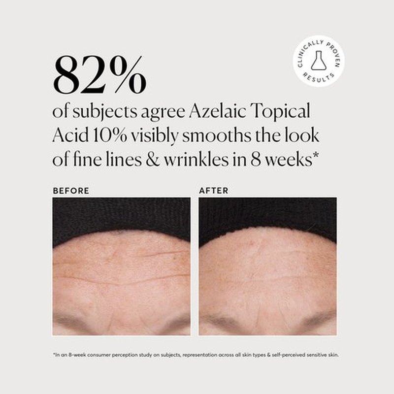 Naturium Azelaic Topical Acid 10% Jumbo, Face & Skin Care Beauty Treatment with Niacinamide & Vitamin C, 2 oz