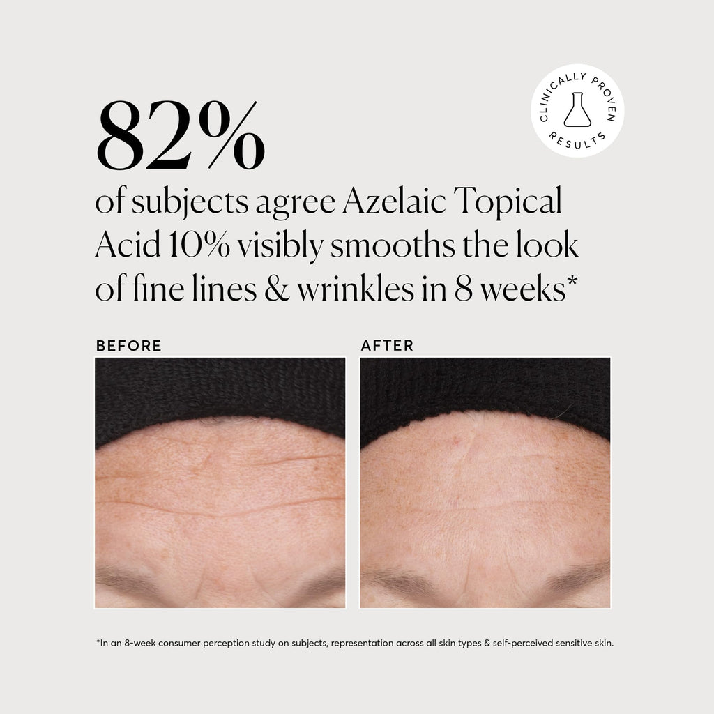 Naturium Azelaic Topical Acid 10% Jumbo, Face & Skin Care Beauty Treatment with Niacinamide & Vitamin C, 2 oz