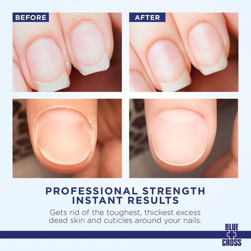 Blue Cross Cuticle Remover & Softener - Hydrating Treatment for Dry Cuticles, 6oz