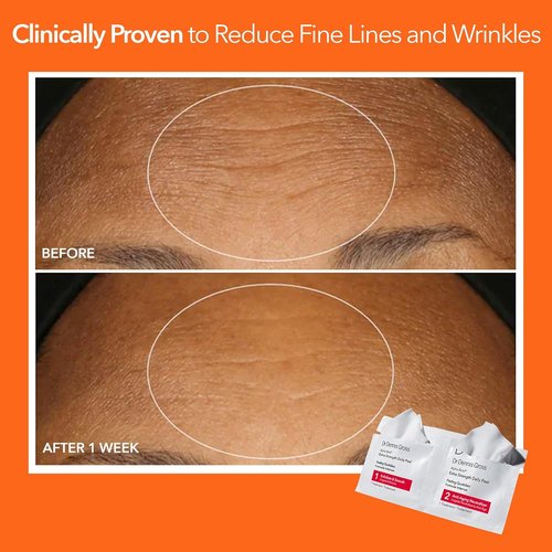 Dr. Dennis Gross Alpha Beta Extra Strength Daily Peel - 2-Step Exfoliating Pads for Radiant Skin | 5 Treatments