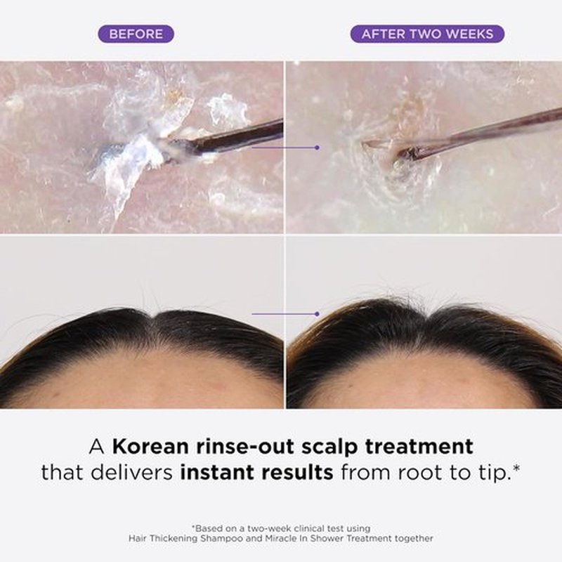 Dr. Groot Miracle In Shower Hair Moisturizing Treatment - Rosemary Oil Scalp Revitalizer for Healthier Hair