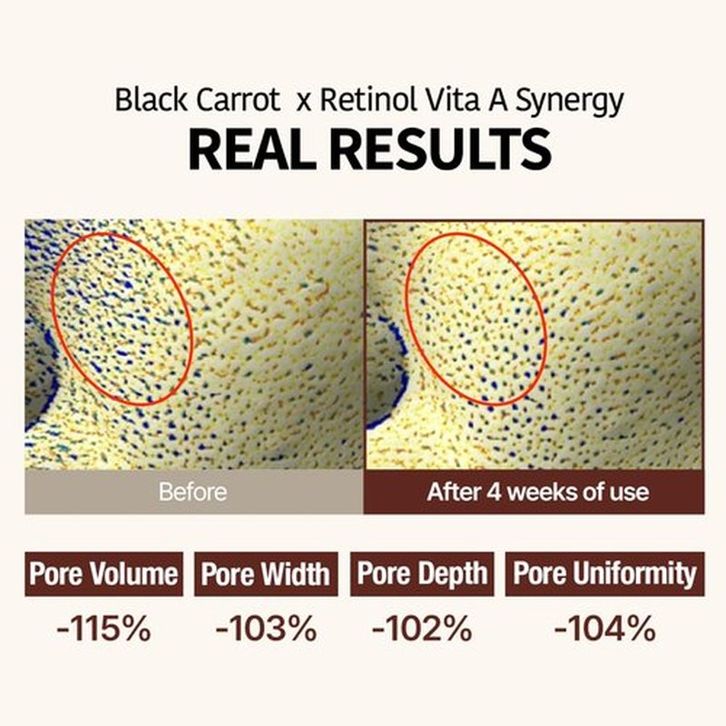 Goodal Black Carrot VITA-A Retinol Ampoule 30ml - Hydrating Facial Serum for Glowy Skin