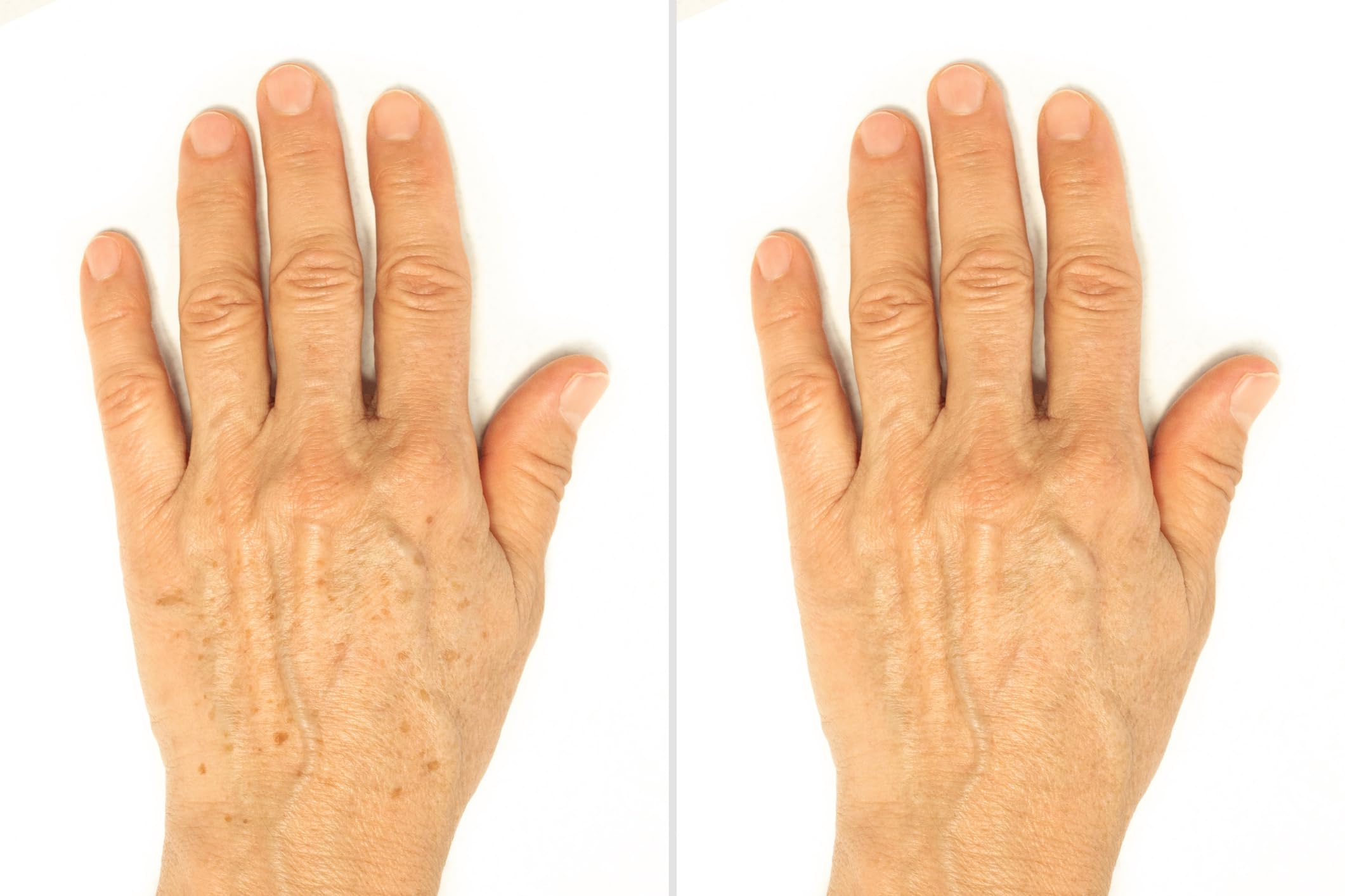 Vitality Precision Skin Micro-Exfoliating Scrub