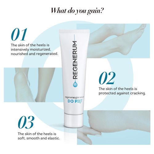 Regenerum Heel Regenerating Serum - Intensive Care for Dry and Cracked Heels | Hydrates, Regenerates, and Prevents Cracking | Softens and Protects Skin - 30g