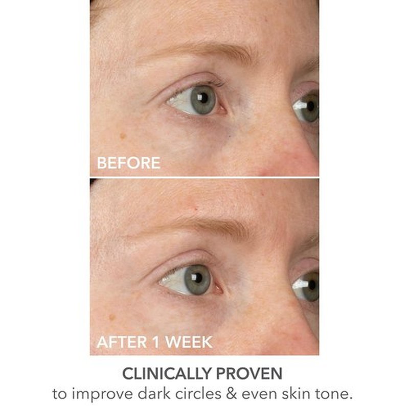 Dr Dennis Gross DermInfusions Lift + Repair Eye Mask | Visibily Lift + Firm, Fills the Appearance of Fine Lines, Deepy Hydrates + Repairs, Visibly Depuffs the Undereye Area | 4 Treatments