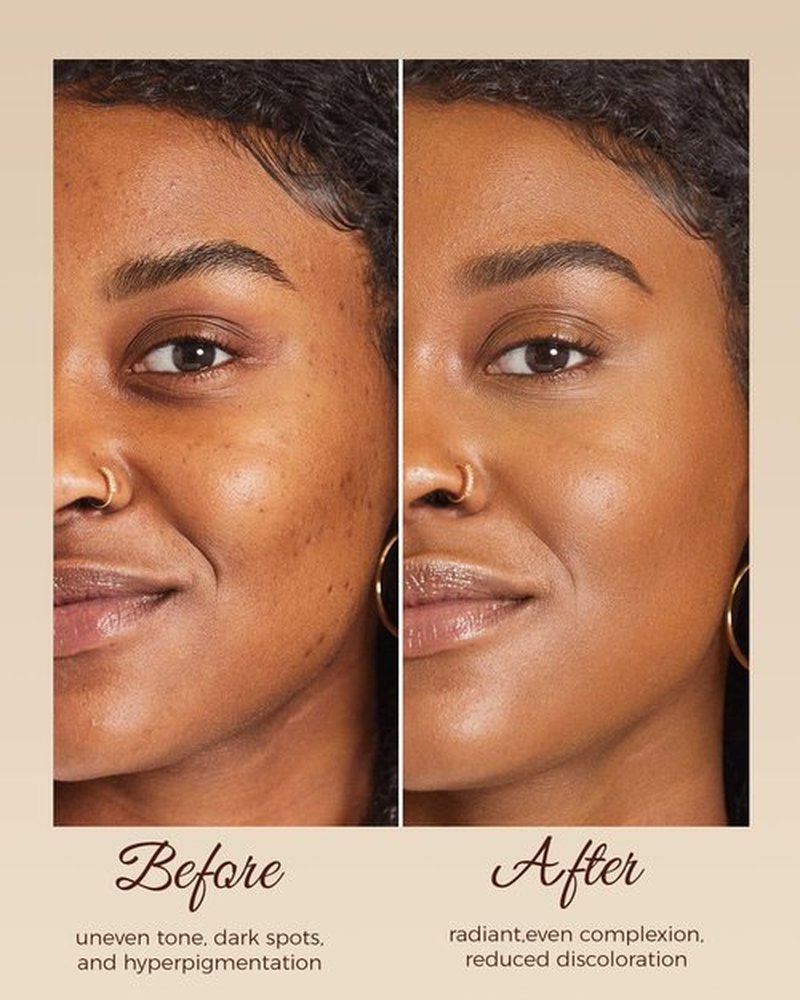 SecuMake Kojic Acid Soap, Brightening & Hydrating Turmeric Soap Bar for Dark Spots with Vitamin C and Shea Butter, Paraben & Sulfate-Free - 2 Bars with African Net Sponge