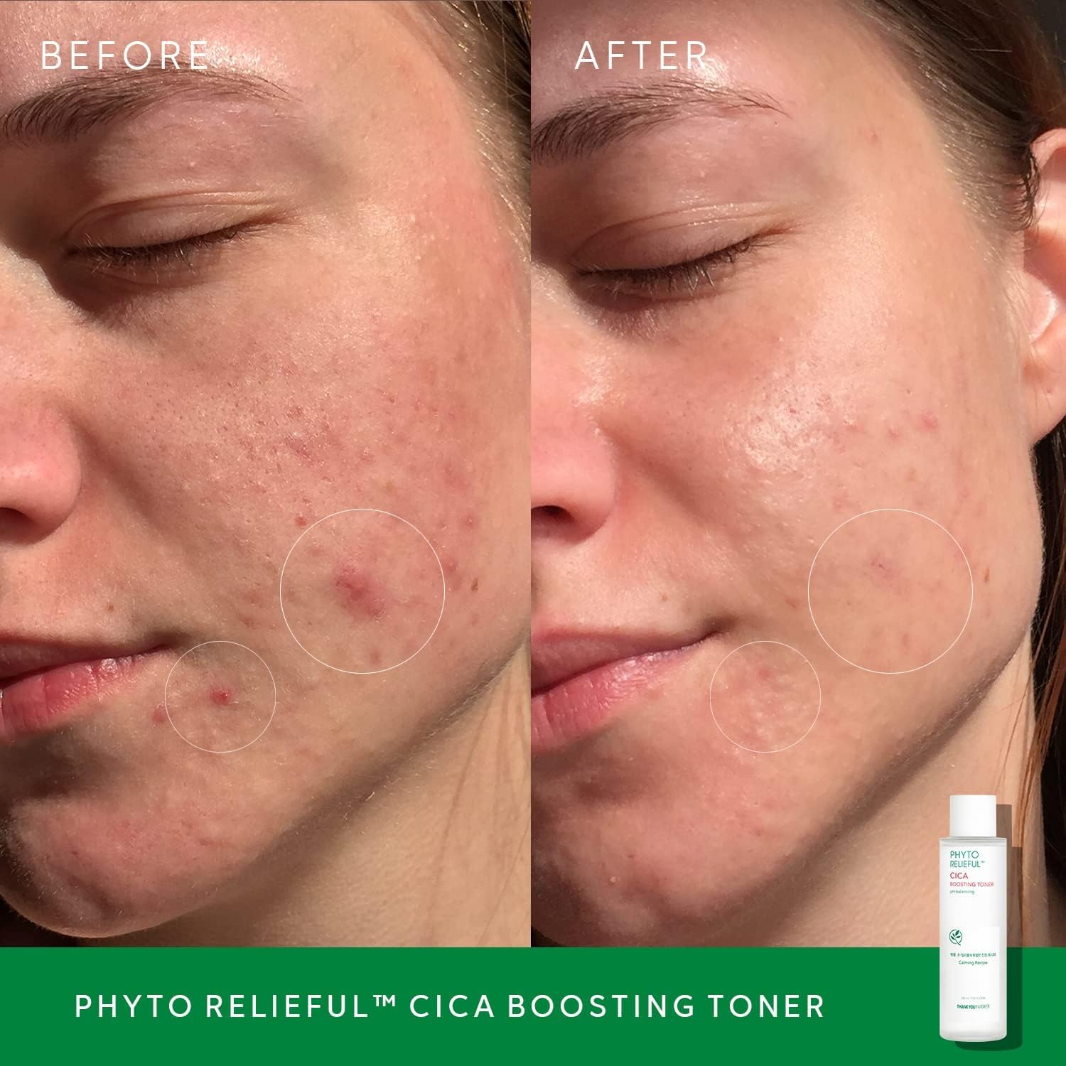 THANKYOU FARMER Phyto Relieful CICA PHA LHA Boosting Toner 7.03 fl oz (200ml), Dermatologist Tested, Alcohol-Free Liquid Exfoliant for Face, Oil-Free Hydrating Toner, Vegan, Fragrance-Free
