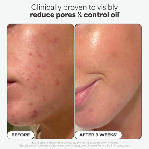 Paula's Choice SKIN PERFECTING 2% BHA Exfoliating Pads - Target Blackheads & Pores, 60 Count