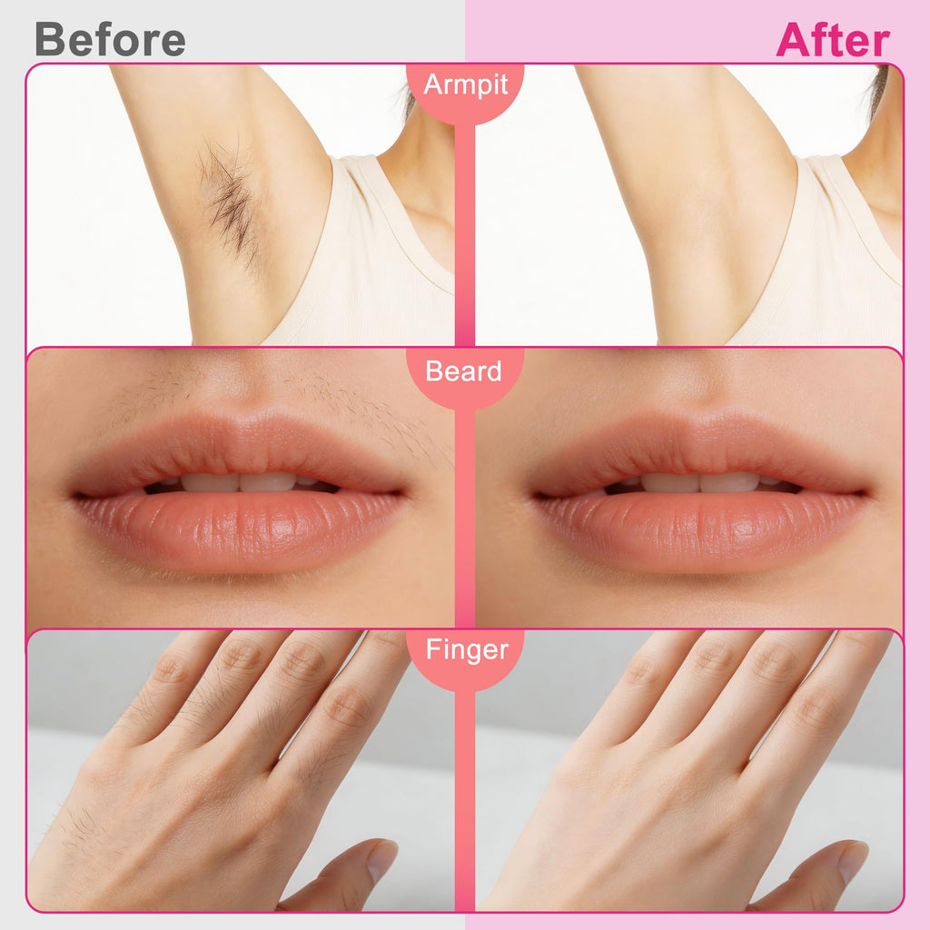 20Pcs Facial Wax Strips for Women, Upper Lip & Eyebrow Hair Removal, Hypoallergenic for Sensitive Skin, Removes Even Short Hair, Up to 5 Weeks Smooth, Easy No-Heat Waxing Kit, 10 per Bag PH