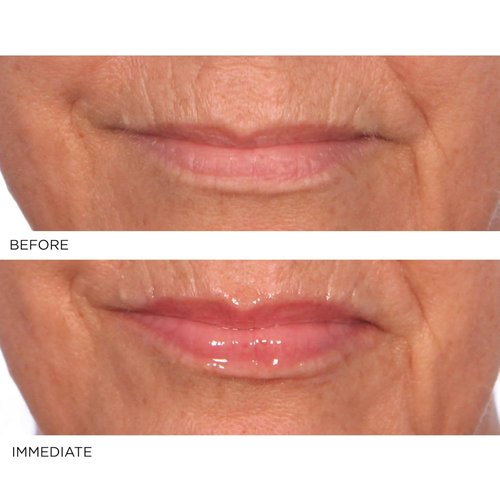 NassifMD Hydro-Screen Lip Plumping Oil - Hydrating Serum with Hyaluronic Acid & Ceramide Jojoba Gloss