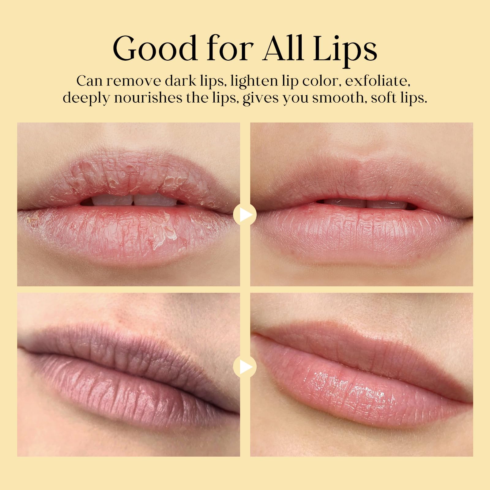 Freeorr Turmeric Lip Treatment Kit for Dark Lips, Lip Scrub&Lip Balm for Smokers, Lip Exfoliator Scrub for Hydration Chapped and Cracked Peel Lips