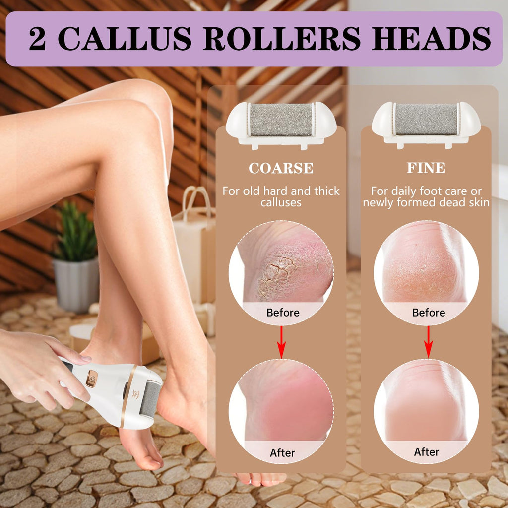 Bikini Trimmer for Women, 4 in 1 Electric Razors for Women Pubic Hair, Epilator and Electric Callus Remover Set, Wet/Dry Use Body Hair Trimmer, Rechargeable Hair Removal for Bikini Legs Underarm Arm