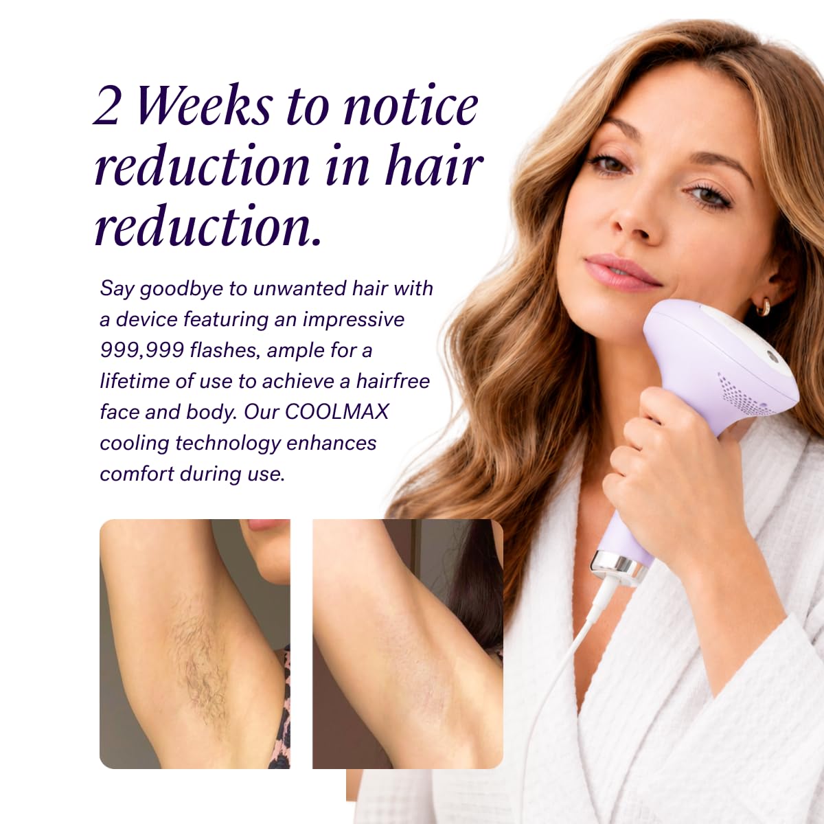 MICHAEL TODD BEAUTY - LUMOS Laser IPL Hair Removal Device for Women and Men, 50°F CoolMax Technology, 999,999 Flashes, 3 in 1 with Skin Sensor for Nearly Painless, Permanent Hair Removal