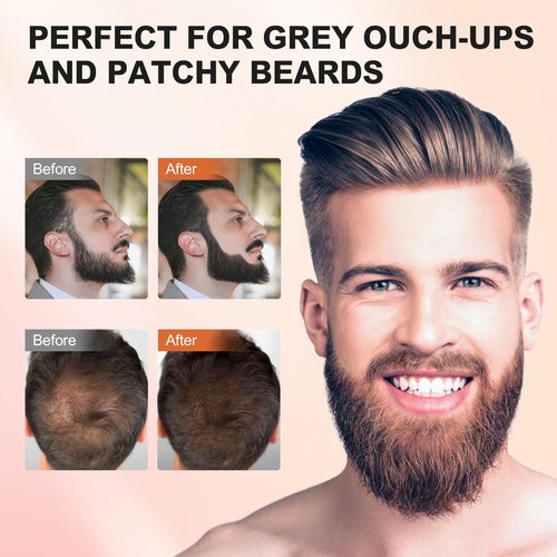 Acosexy Root Touch Up Powder, Hairline Shadow Concealer for Women's Eyebrows and Men's Beard Lines, Covers Bald Spots (Medium Brown)