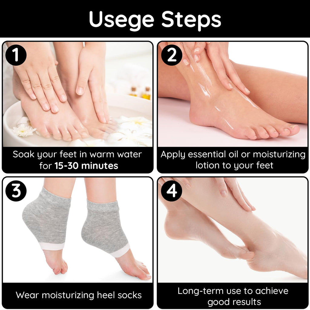 Segbeauty 16pcs Lotion Socks for Dry Feet Overnight, 8 Pairs Moisturizing Heel Gel Socks for Dry Feet Cracked Heel, Foot Care Feet SPA Socks for Men and Women, Open Toe Foot Socks Sleeping Overnight