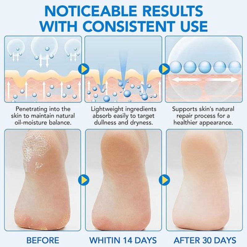 Skiennix Urea Foot Cream Stick - 60% Urea & 2% Salicylic Acid for Dry Cracked Skin | 1.41 oz