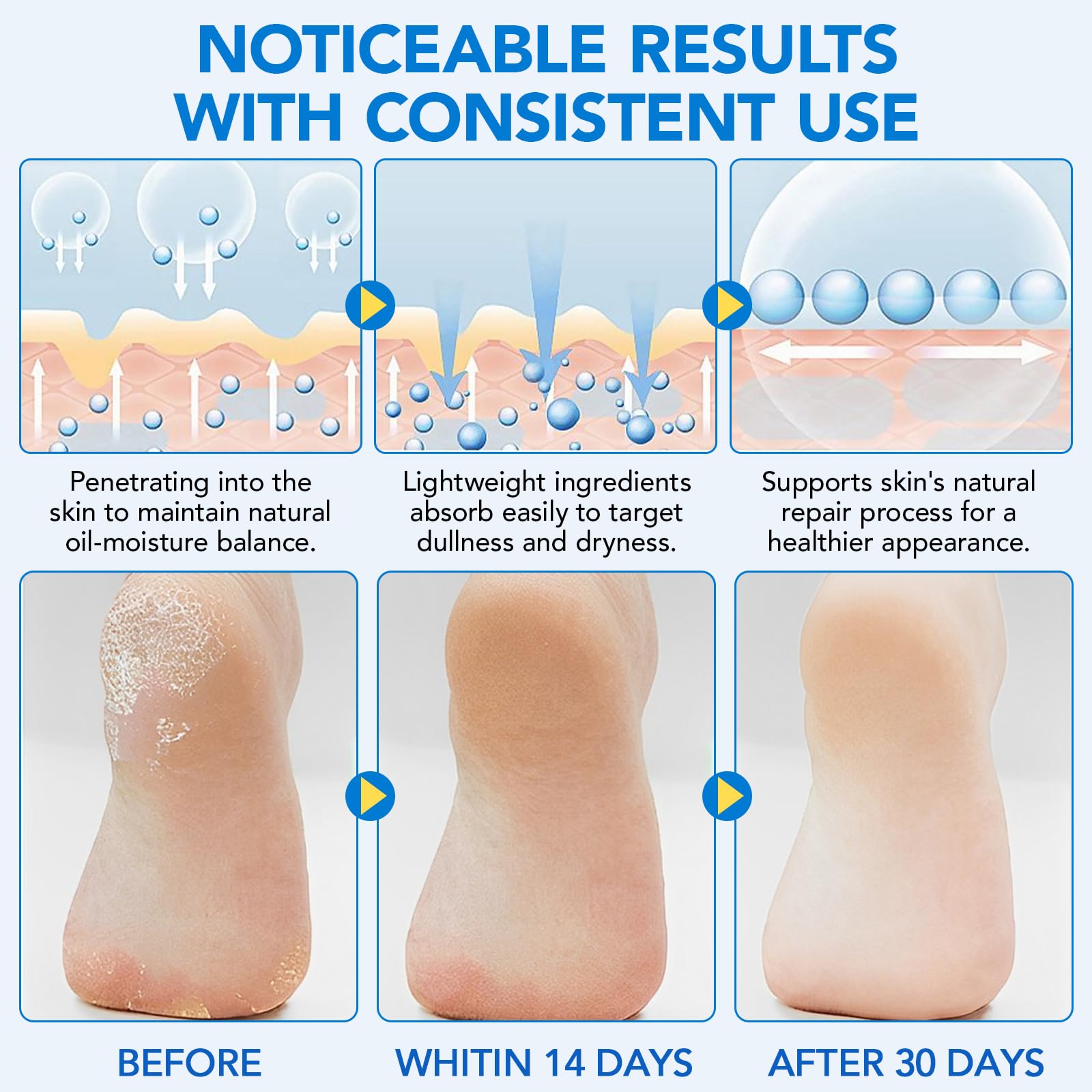 WeiWeiLa Urea Cream, Intensive Foot Repair Stick 60% Urea with 2% Salicylic Acid Heel Balm Stick, Maximum Strength Callus Remover Foot Care Cream for Cracked Heels, Dry Feet & Rough Skin