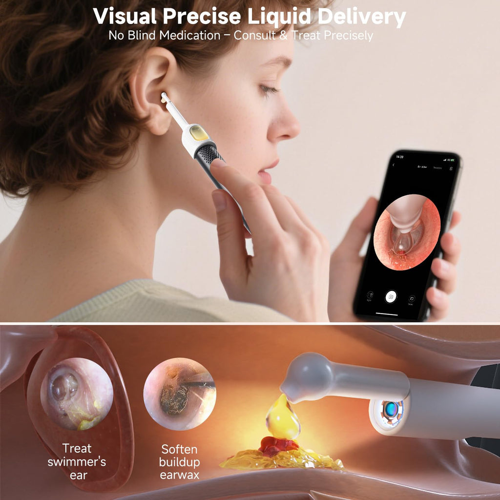 BEBIRD R1 Ultra Ear Wax Remova, Ear Cleaner with Camera Ear Scope, Wax Remove Ear Pick with Ear Otoscope Tweezers, Visual Dropper Cleaning Kit, Ear/Nose/Throat Examination Tool for Family, Black